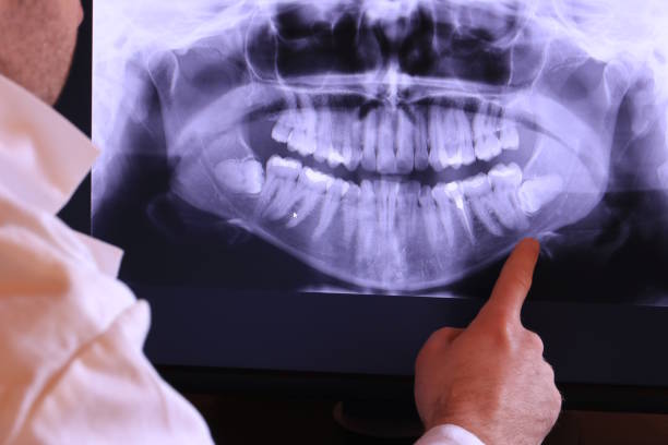 Best Broken or Chipped Tooth Repair in Rockford, MN