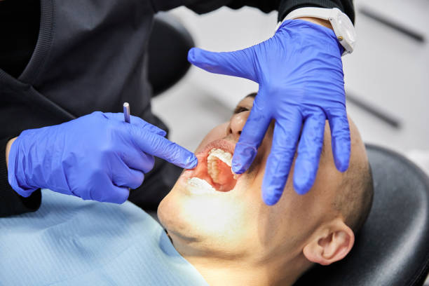 Best Knocked-Out Tooth (Avulsed Tooth) Treatment in Rockford, MN